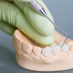 Dentist prodding model of teeth with dental bridge