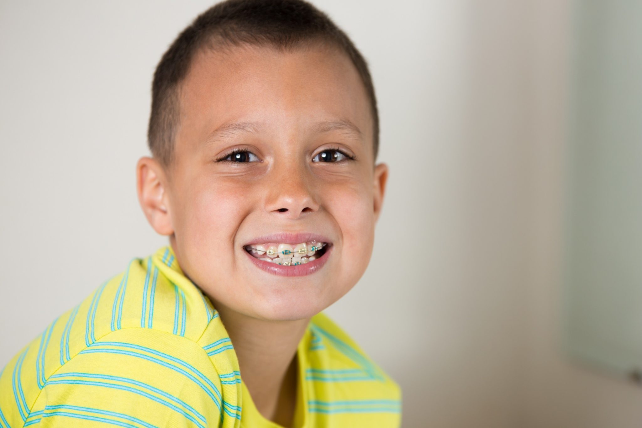 Common Signs Your Child Needs Braces for Children